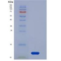 人ALK-1 / ACVRL1重组蛋白His tag