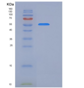 人CHST15 / GALNAC4S-6ST / BRAG重