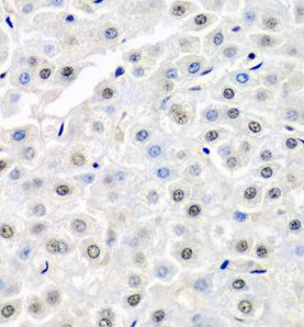 SF3B3 antibody|SF3B3抗体