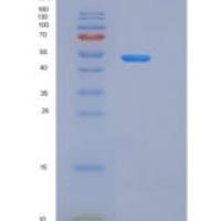 人Clusterin / Apolipoprotein J / Apo-J / CLU重组蛋白His tag