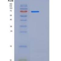 小鼠SHP2 / PTPN11重组蛋白His tag
