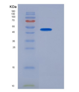 人SerpinA6 / CBG 重组蛋白His tag