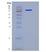 人HSPD1 / HSP60重组蛋白His & GST ta