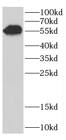 AK8 antibody|AK8抗体