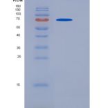 小鼠CHST5 / GlcNAc6ST-3重组蛋白Fc Tag