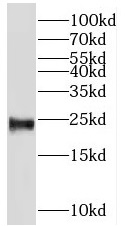 PSG11 antibody|PSG11抗体