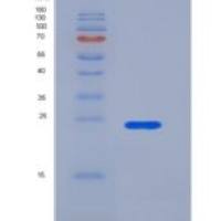 人2B4 / SLAMF / CD244重组蛋白His tag