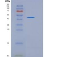 人DUSP3 / VHR重组蛋白His & GST tag