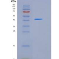 小鼠ENTPD5重组蛋白His tag