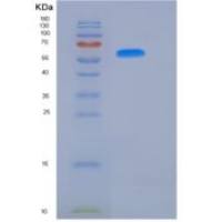 人岩藻糖基转移酶8(FUT8)重组蛋白aa 68-575, His tag