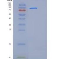 人CEACAM5 / CD66e重组蛋白His & Fc tag
