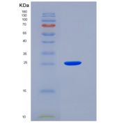 小鼠JAM3 / JAM-C重组蛋白His tag