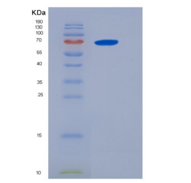 人IL6ST / gp130 / CD130重组蛋白
