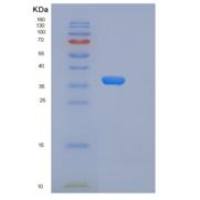 人SFTPD / SP-D / SFTP4重组蛋白His tag