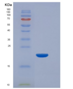 小鼠TIM-3重组蛋白His Tag