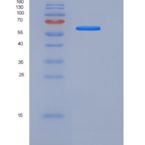人CD55 / DAF重组蛋白Fc tag