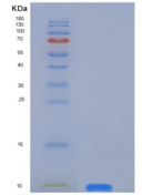 人Defensin / Beta-defensin 3 /