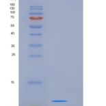 人S100钙结合蛋白A8(S100A8)重组蛋白His Tag
