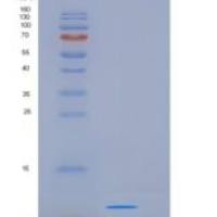 人S100钙结合蛋白A8(S100A8)重组蛋白His Tag