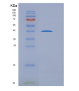 人CD5分子(CD5)重组蛋白His tag