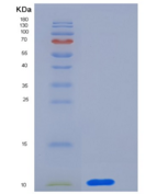 人CD9 / Tspan-29重组蛋白His tag