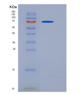 小鼠CHST5 / GlcNAc6ST-3重组蛋白Fc Ta