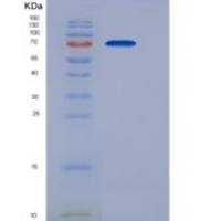 人奎宁水一号(Kininogen 1)重组蛋白His Tag