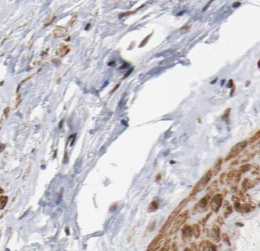 SS18L2 antibody|SS18L2抗体