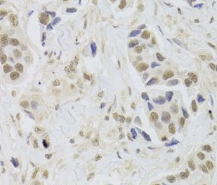 UBE3C antibody|UBE3C抗体