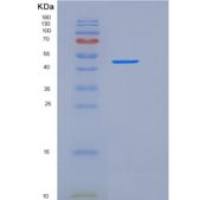 小鼠Osteomodulin / OMD重组蛋白His tag