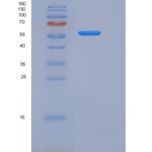 人纤连蛋白亮氨酸丰富跨膜蛋白2(FLRT2)重组蛋白His Tag