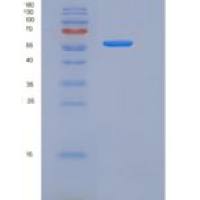 人纤连蛋白亮氨酸丰富跨膜蛋白2(FLRT2)重组蛋白His Tag