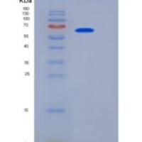 人肝配蛋白A受体4(EPHA4)重组蛋白His tag