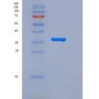 人CD55 / DAF重组蛋白His tag