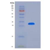 人JAML / AMICA重组蛋白His tag