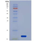 人ALK-1 / ACVRL1重组蛋白His tag