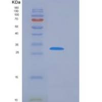 人Cathepsin V / Cathepsin L2 / Preproprotein重组蛋白His tag