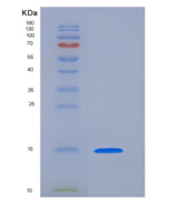 人PHPT1 / PHP14重组蛋白His tag