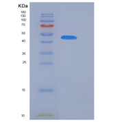 小鼠丝氨酸蛋白酶抑制剂A11(SERPINA11)重组蛋白H