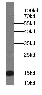 BLOC1S1-Specific antibody|BLOC