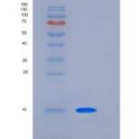 人LAIR2 / CD306重组蛋白His tag