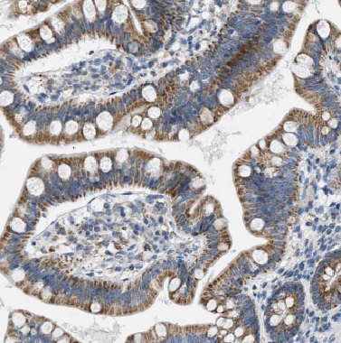 R3HCC1L antibody|R3HCC1L抗体