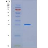 人METTL11A重组蛋白