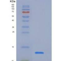 人ALK4 / ACVR1B重组蛋白His tag