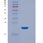 小鼠TIM-3重组蛋白His Tag