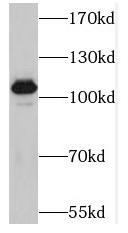 MAP3K10 antibody|MAP3K10抗体
