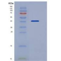 小鼠外异蛋白A2受体(EDA2R)重组蛋白Fc Tag