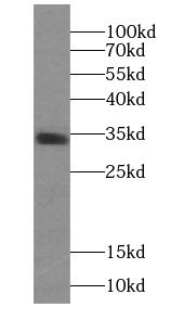 PPP1R2C antibody|PPP1R2C抗体