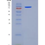 人HSPD1 / HSP60重组蛋白His & GST tag