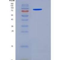 人HSPD1 / HSP60重组蛋白His & GST tag